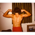 1974 13yo nice scoliosis